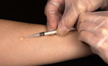 Bezpłatne szczepienia przeciwko HPV dla uczniów z Katowic